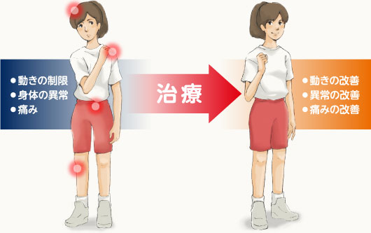 人の動きと痛みの発想イメージ